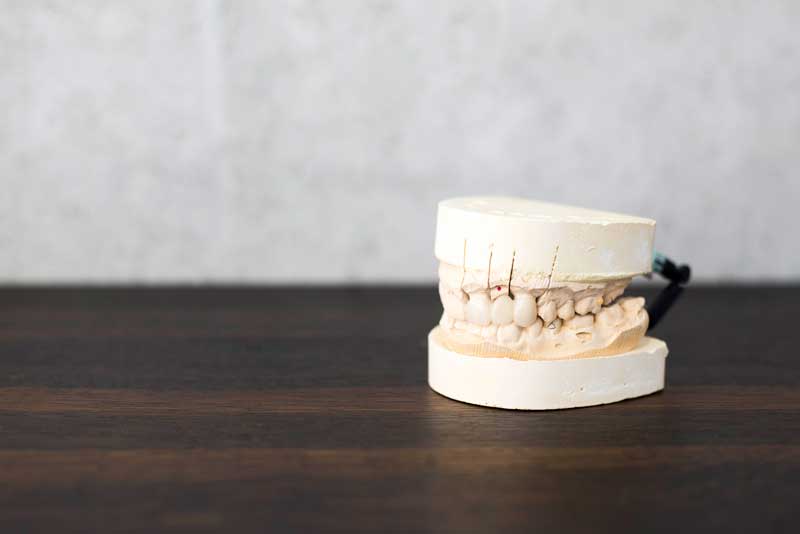 https://www.thedentisthouston.com/gingivitis/