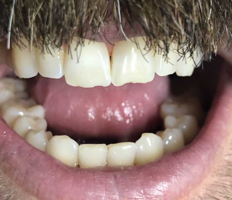 Cosmetic Dentistry Houston | One of the Best Cosmetic ... Cosmetic Dentistry Houston | One of the Best Cosmetic ...