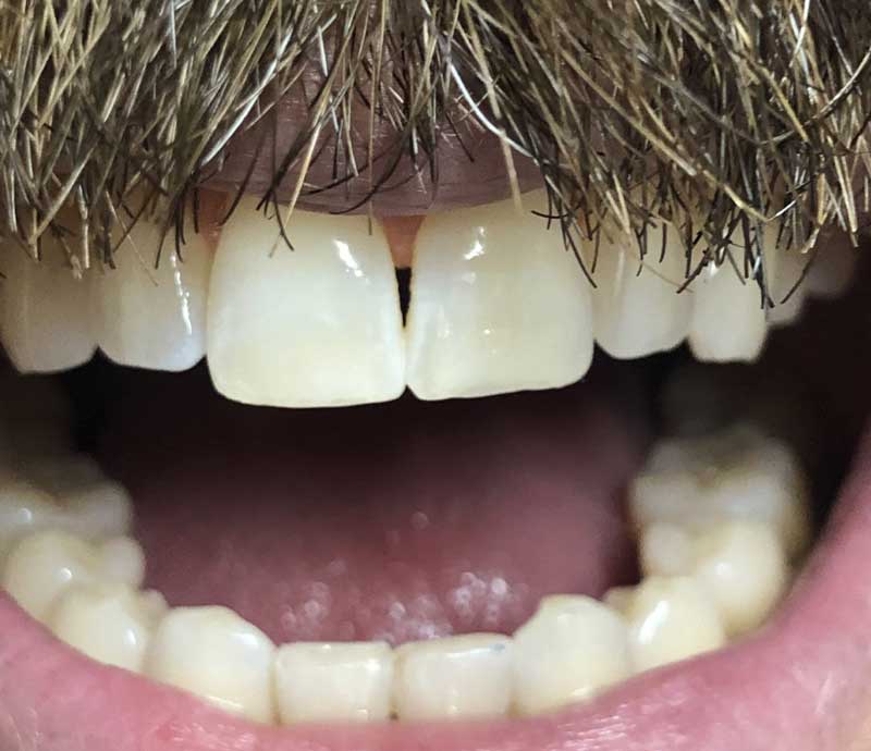 Cosmetic Dentistry Houston | One of the Best Cosmetic ... Cosmetic Dentistry Houston | One of the Best Cosmetic ...